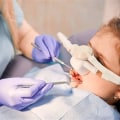 The Role of Sedation in Making Complex Dental Procedures Easier