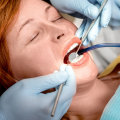 The Benefits and Risks of Conscious Sedation Dentistry